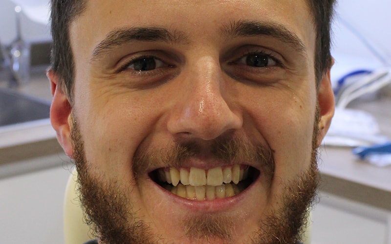 reading-smiles-invisalign-p1-b1.jpg