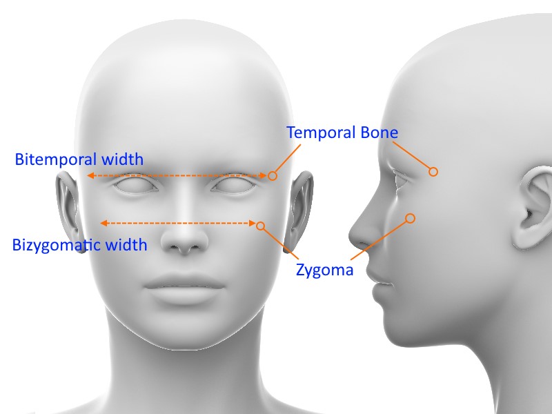 bitemporal-vs-bizygomatic-width.jpg