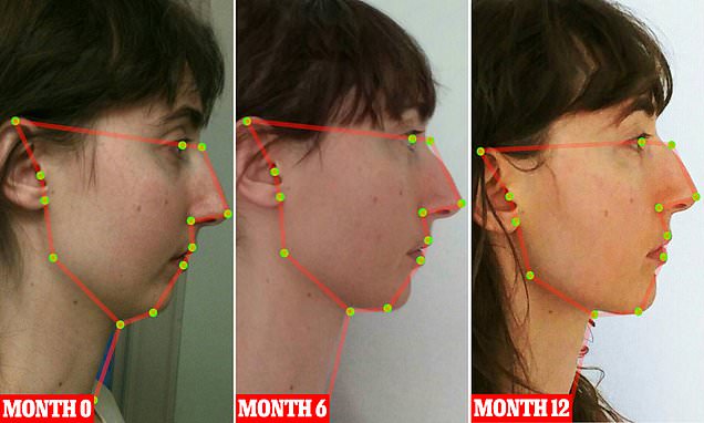 Mewing technique coined by Dr. Mike Mew changes face shape | Daily Mail  Online