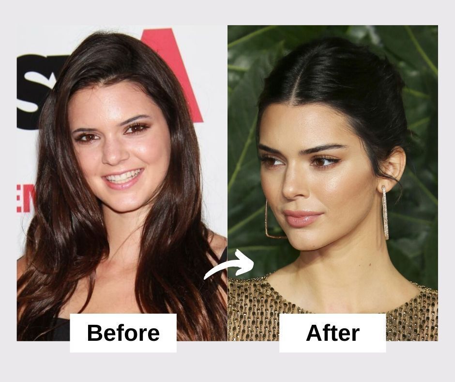 Before.jpg
