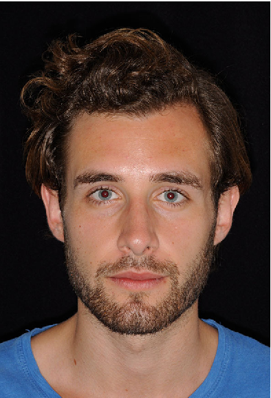 3109095_raffaini_front_after.png