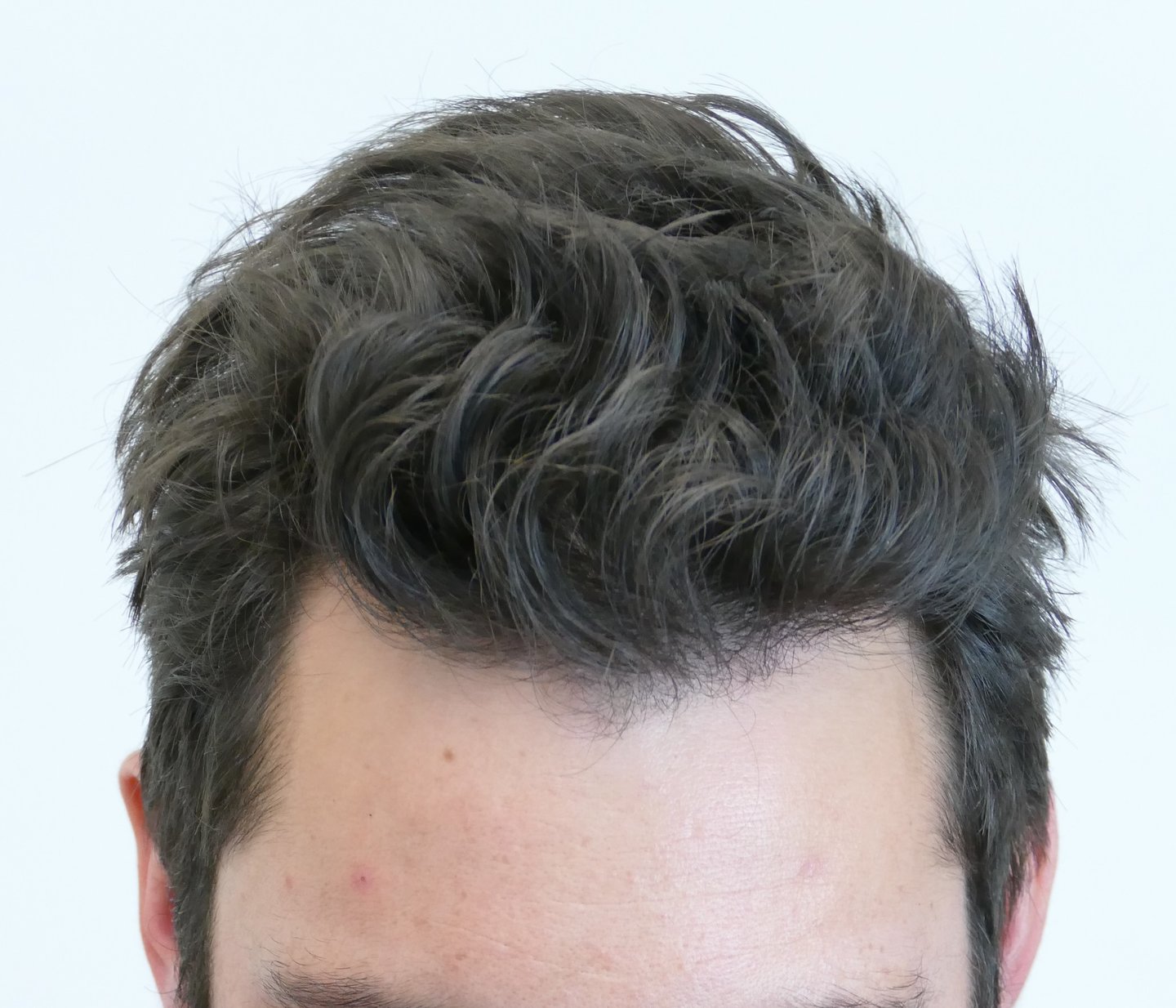 www.hairrestorationnetwork.com