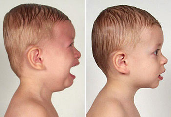 flat-head.jpg