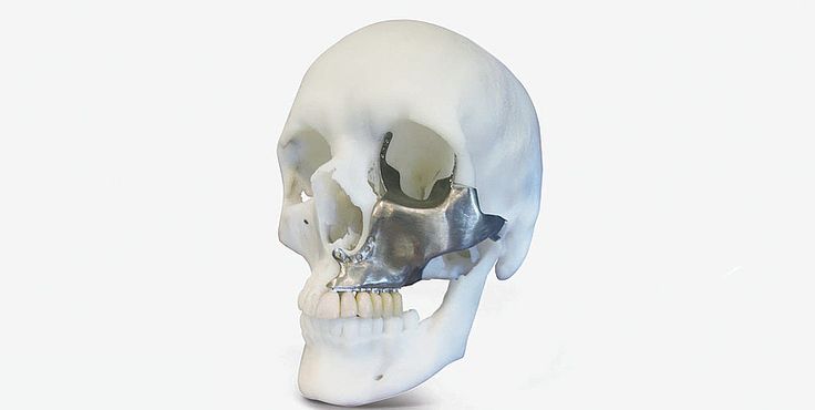 5ee9219e1f5badb64ffc4b6f36e75bc8--facial-implant-a-skull.jpg