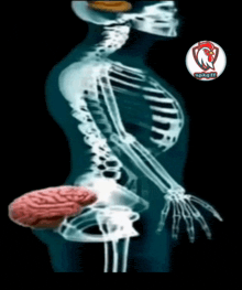 Brain In Ass Meme - Brain in ass - Discover & Share GIFs