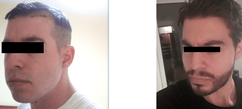 1605578_o4DJePs.png