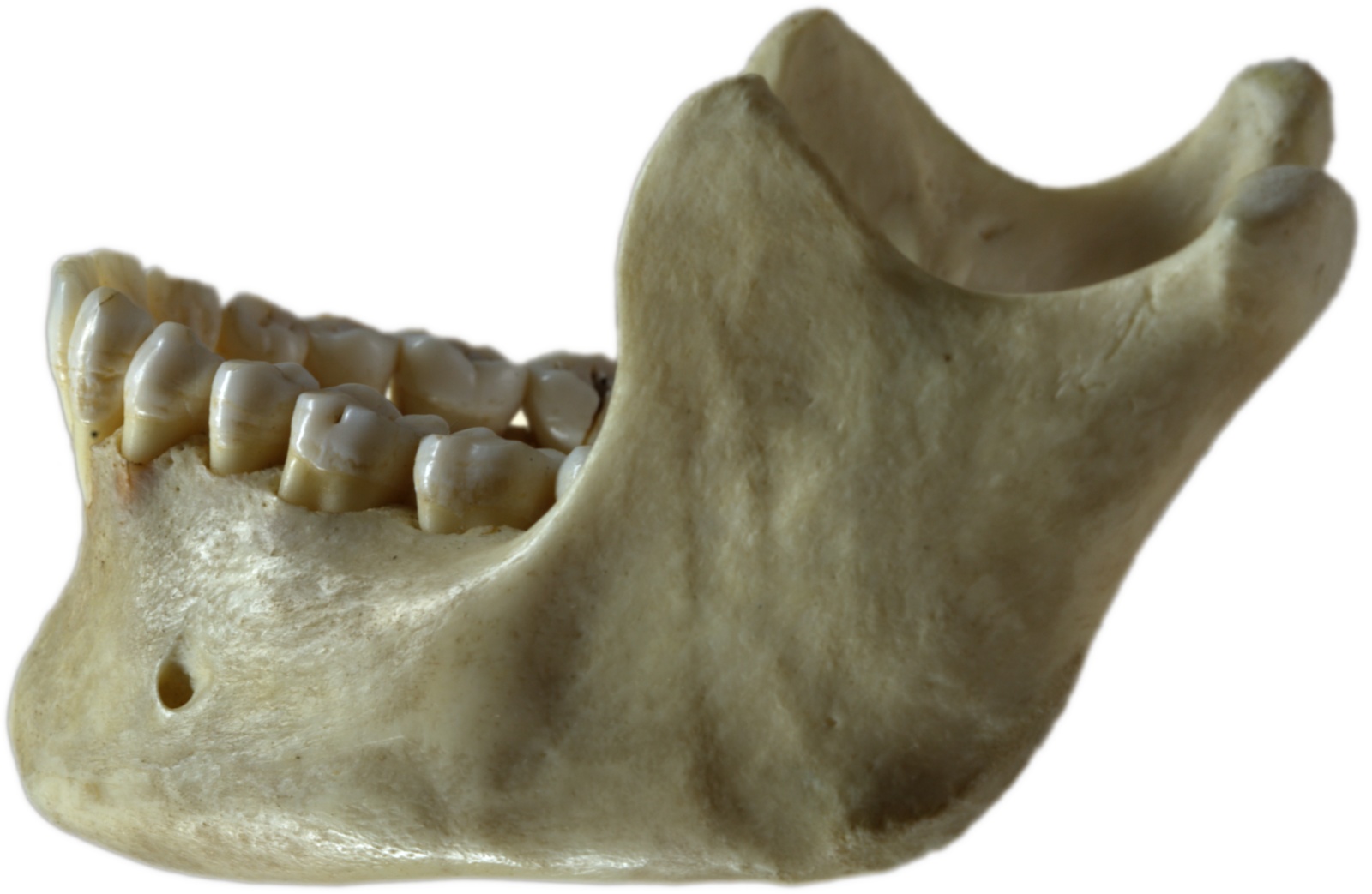 Human_jawbone_left.jpg