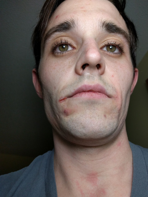 Baldcel1.jpg