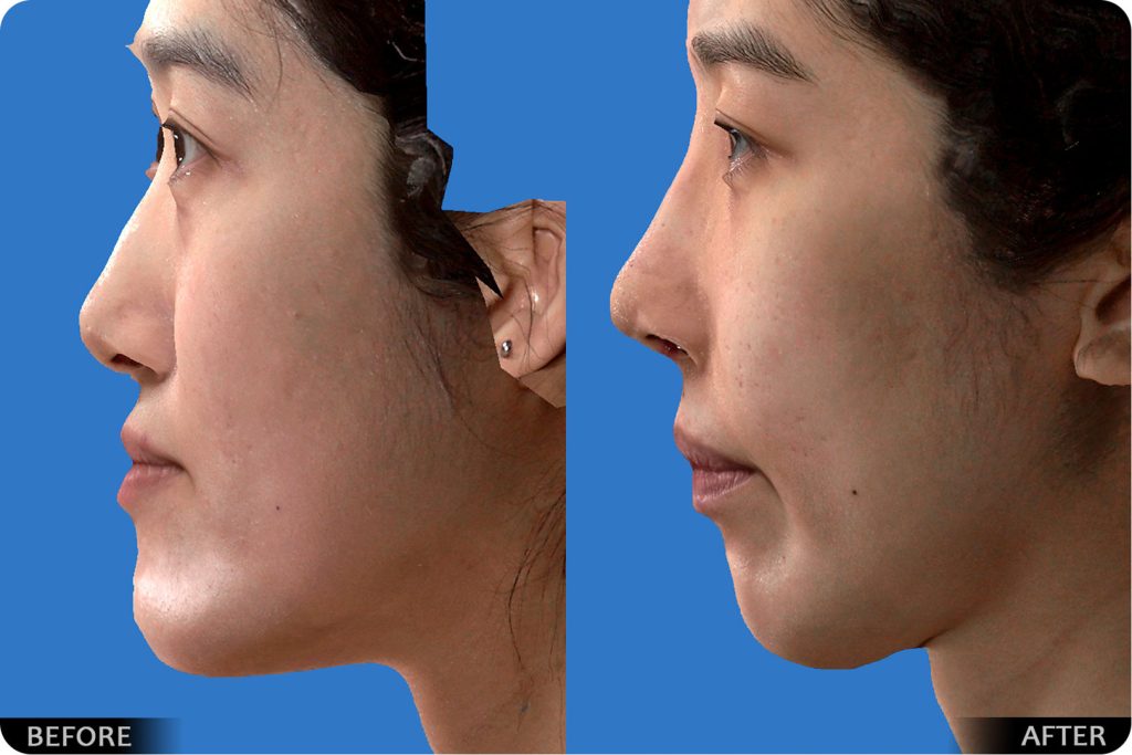 thumbs_Orthognathic_177-1024x683.jpg