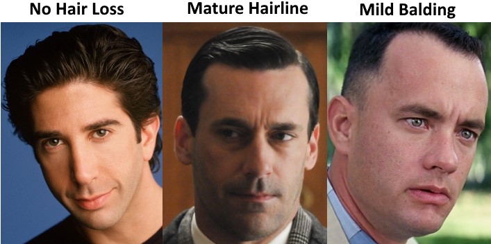 maturehairlineproject1.jpg