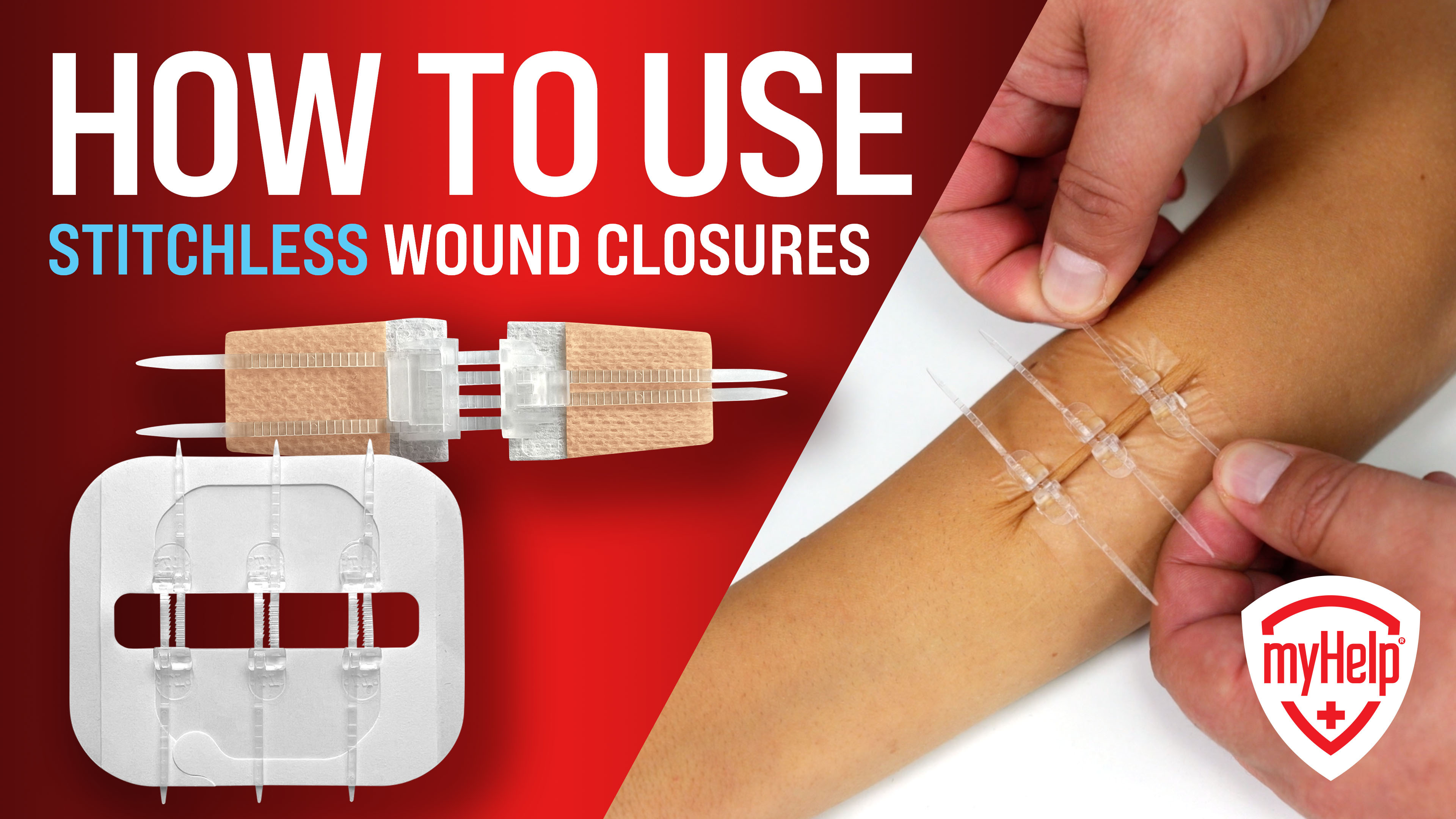 Amazon.com: Emergency Wound Closure Strips - 4pk - 2 Types Sutures Free  Laceration Closure Kit - Stitchless & Easy to Use - Butterfly Bandages for  Cut Care - Perfect for Quick Stop