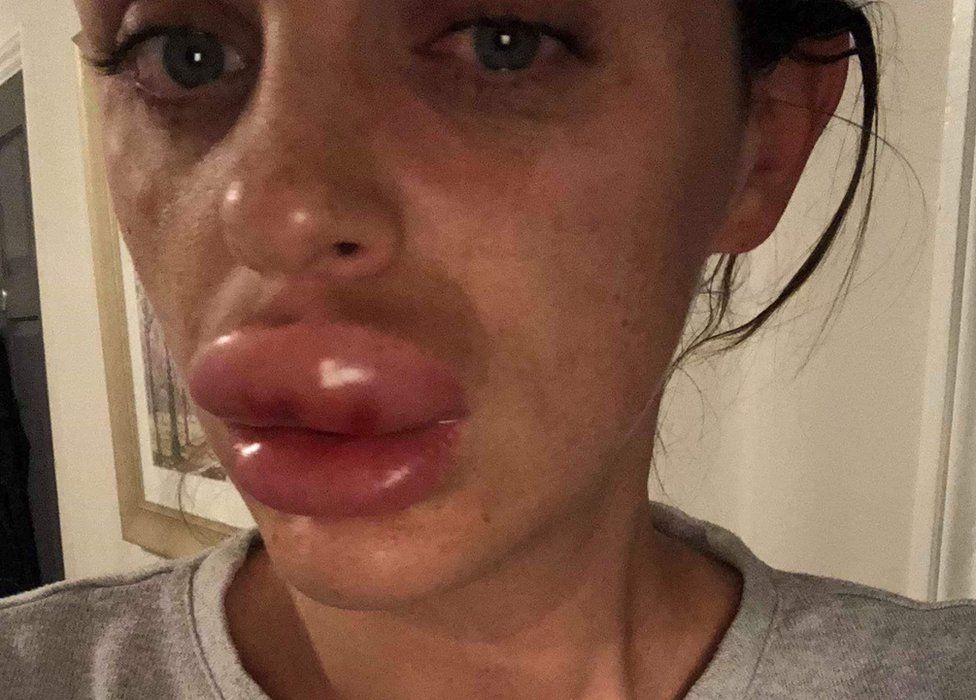 _104618203_lips1.jpg