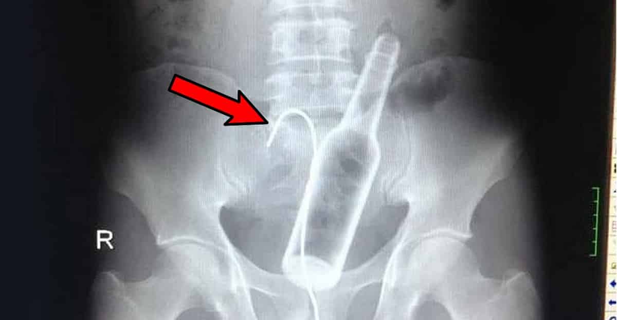 bizarre-xray-results.jpg