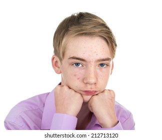 teenager-acne-on-his-face-260nw-212713120.jpg