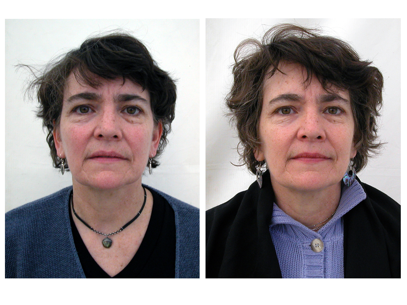 05beforeafter.jpg