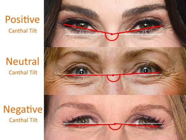 What is a canthal tilt? - Quora