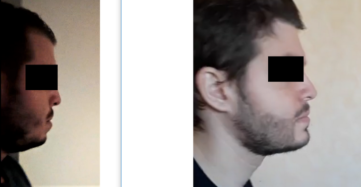 ayiU0kgg.png