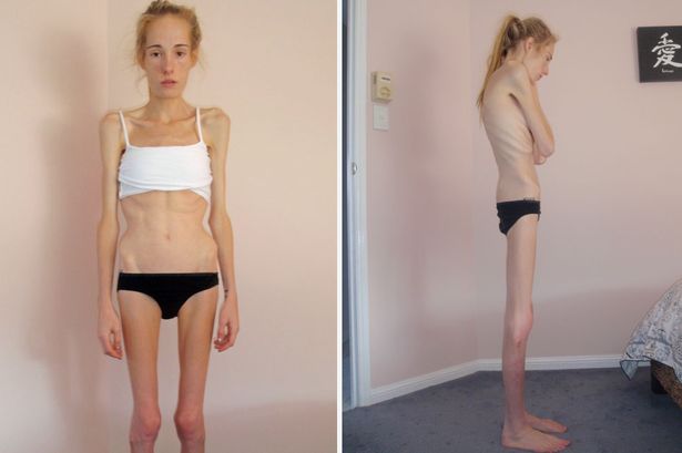 Gemma-Walker-split.jpg