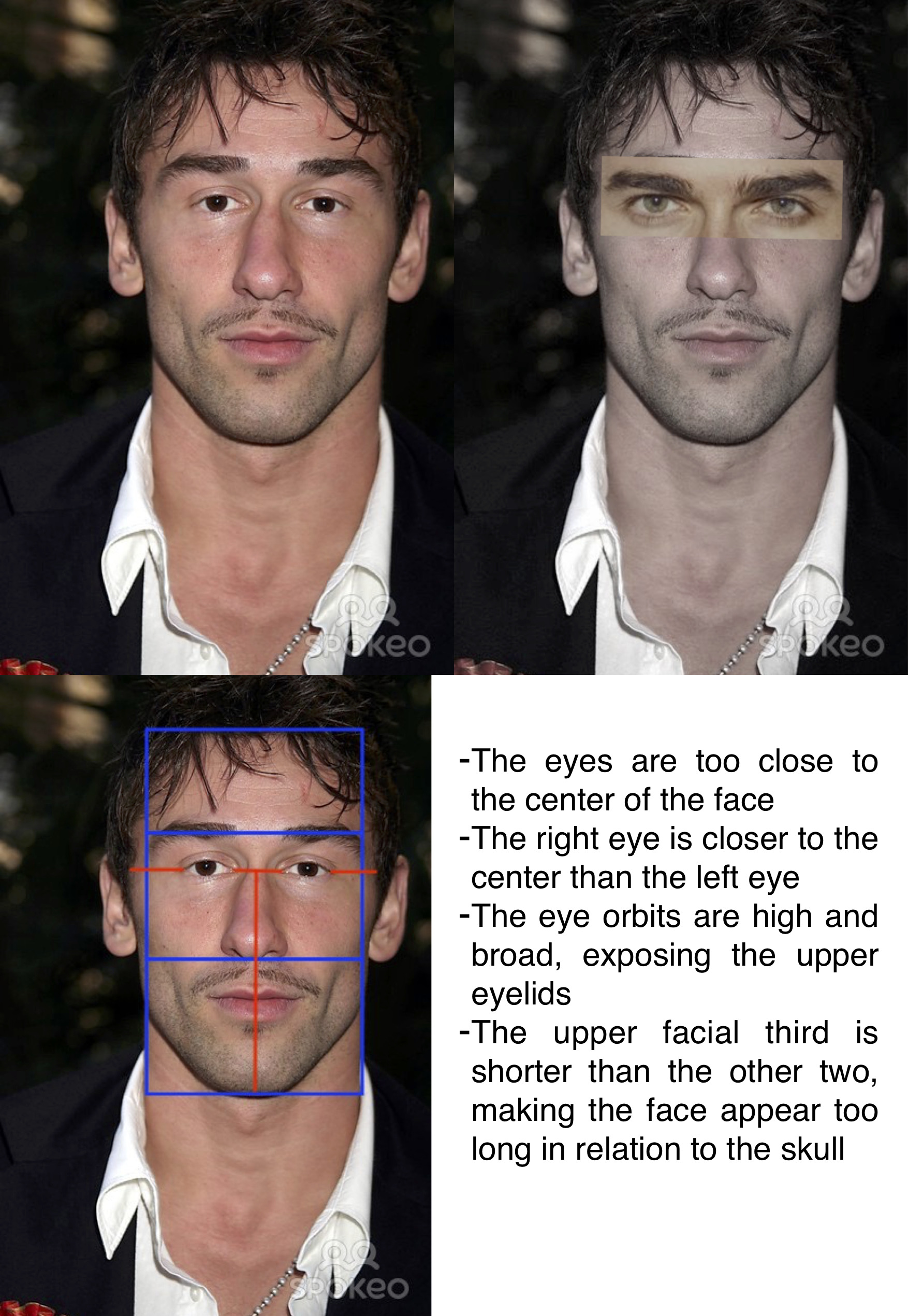 Marko Jaric Eyes Too Close Together