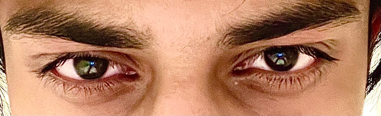 3288106_after_eye.png
