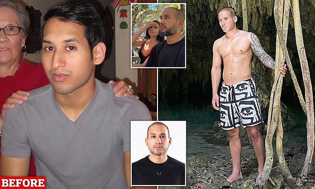 Man splashes $24,000 on surgery in Turkey to get dates