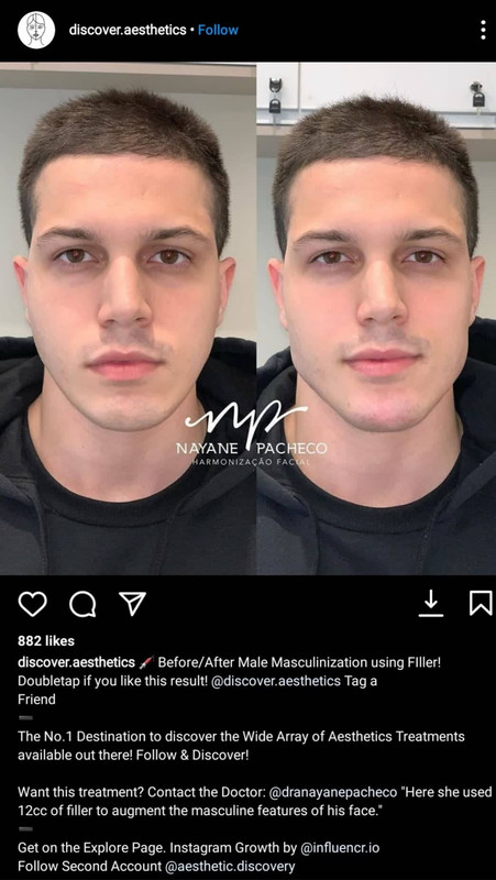 fillers.jpg