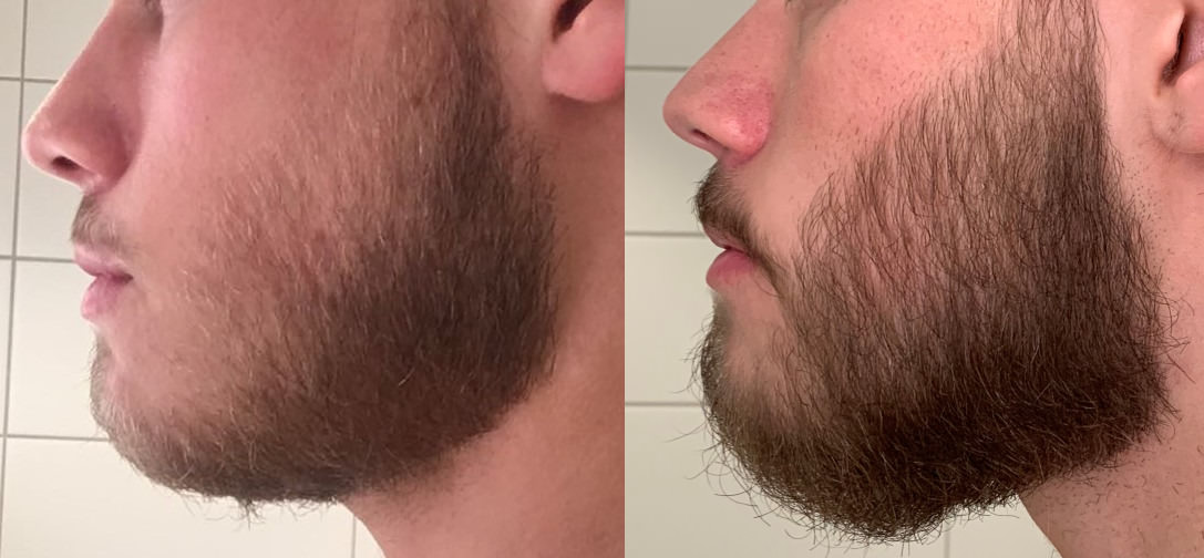 [Image: X3chBVa.jpg]