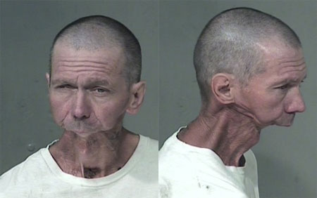 A man missing his lower jaw : WTF