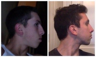 Program for Amazing Facial Changes – Welcome
