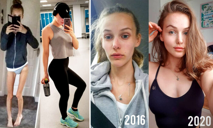et-eating-disorder-web-34-435-700x420.jpg