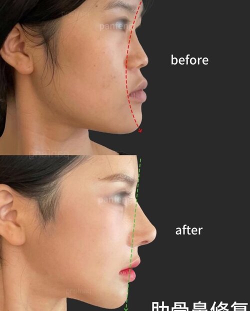 IMG 20260302 232838 730