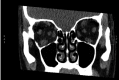 Figure 3. Figure 3.