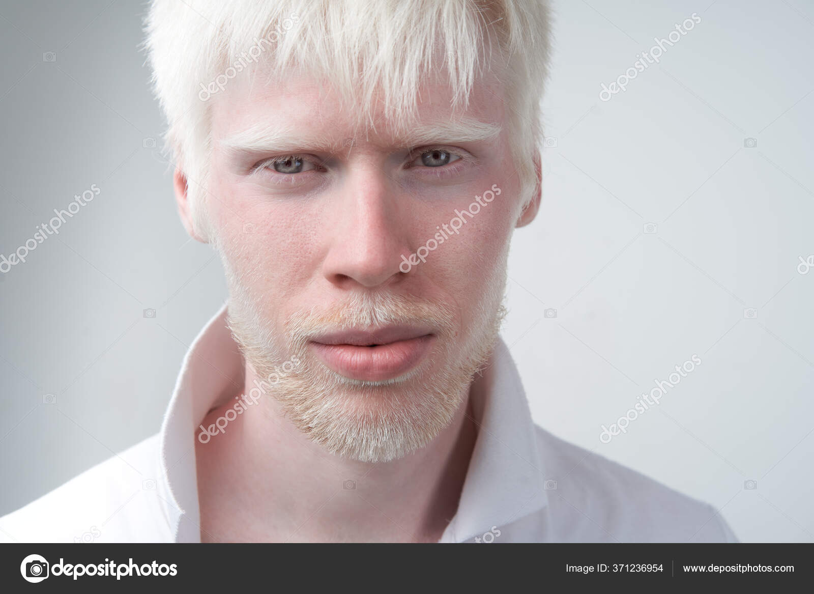 Sad Albino Man White Skin Hair Studio Dressed Shirt Isolated ⬇ Stock Photo,  Image by © andreonegin #371236954