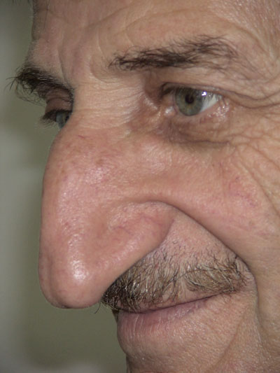 long+nose.jpg
