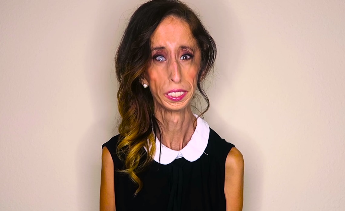 Celebrities Stand With Lizzie Velasquez To Fight Back Against Bullies