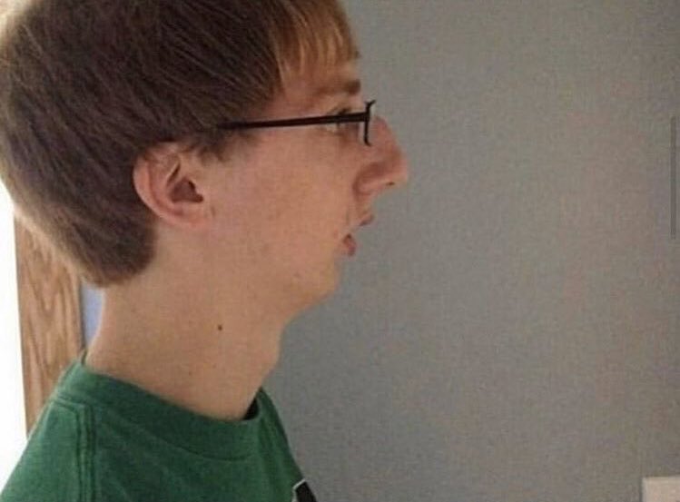 Blockhead on X: Furthermore, will the result in an evolutionary change  where men 2000 years from now will all look like this?  https://t.co/4a9FUWf0ol / X