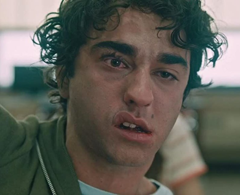 did-alex-wolff-dislocate-his-jaw-in-hereditary-1674059100-view-0.jpg