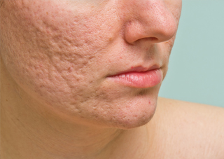 DERM09_320x227_CVRstory.jpg