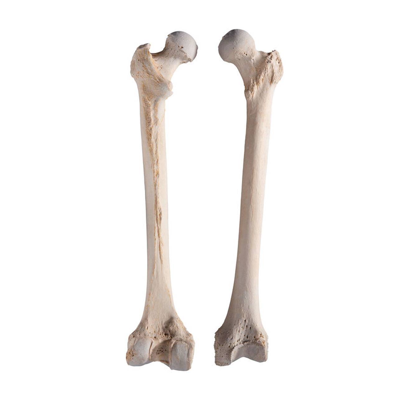 skulls-skeletons-femoral-bones-no-watermark.jpg