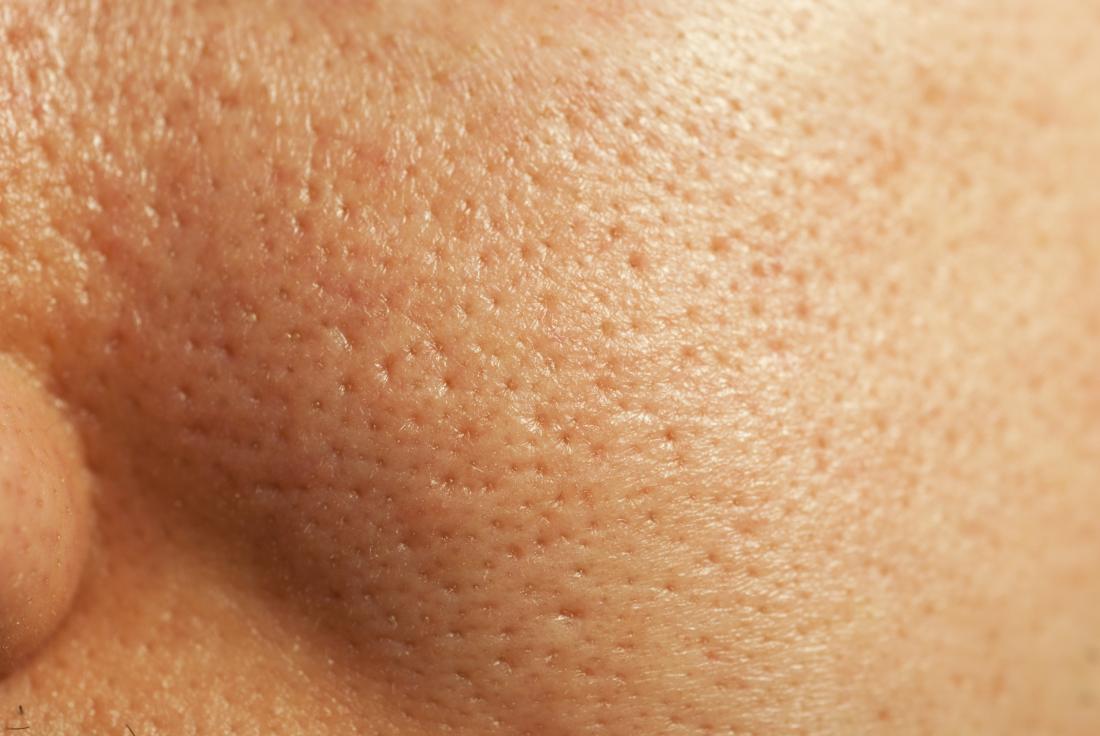 close-up-of-large-pores-on-the-face-and-how-to-get-rid-of-large-pores.jpg