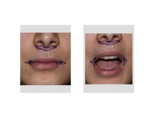 exploreplasticsurgery.com