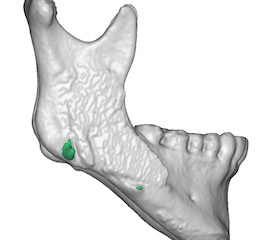 exploreplasticsurgery.com