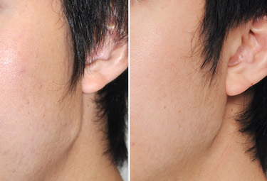 exploreplasticsurgery.com