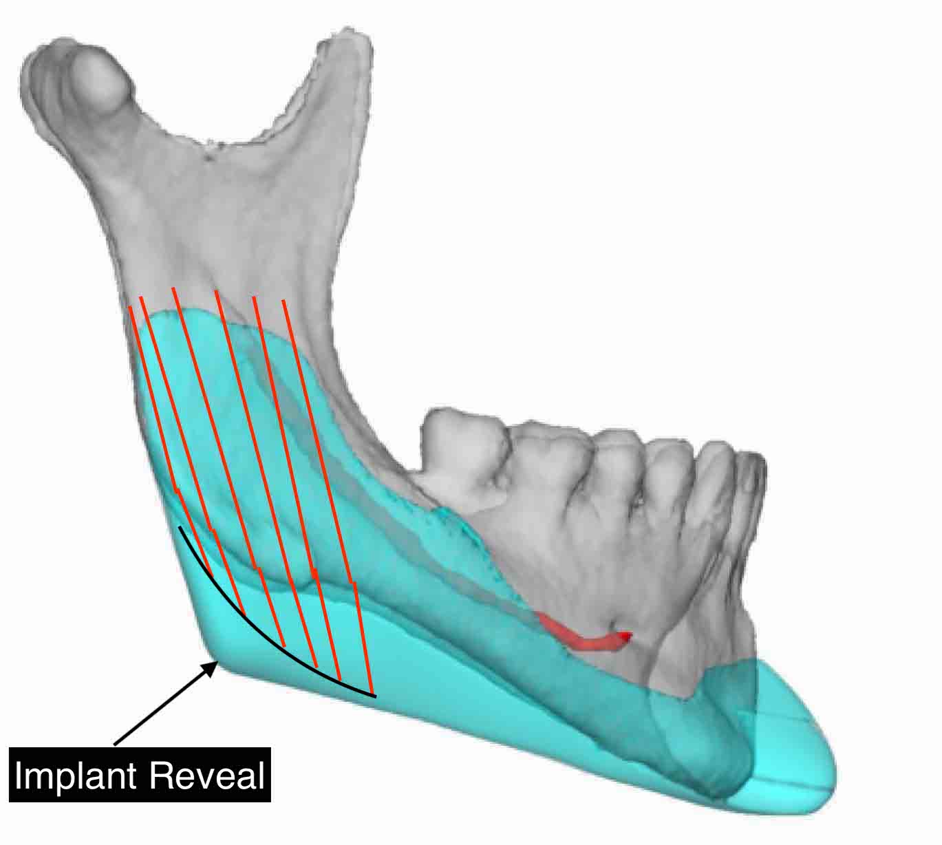 exploreplasticsurgery.com