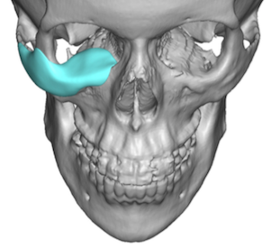 exploreplasticsurgery.com