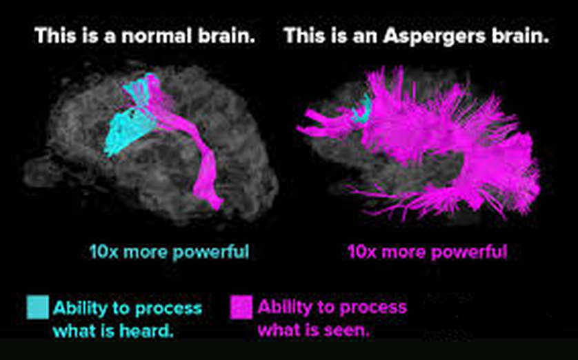 What is Aspergers? - Focus on Your Wellness-Brain and Body Balance-ADHD, Dyslexia, PTSD, Anxiety ...