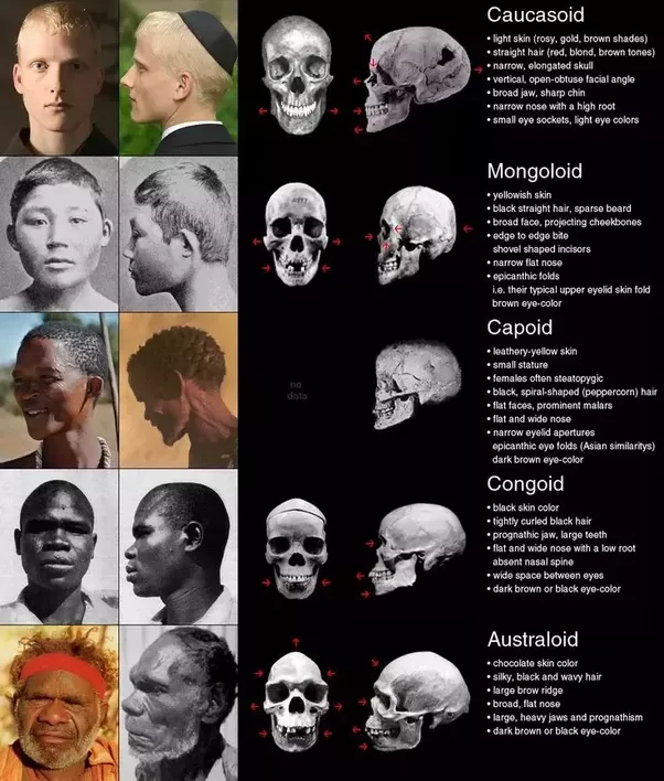 Can you tell a person's race from their skull? - Quora