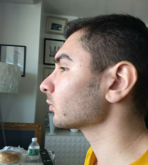 Side profile emphasizing heavy brow ridge Side profile emphasizing heavy brow ridge