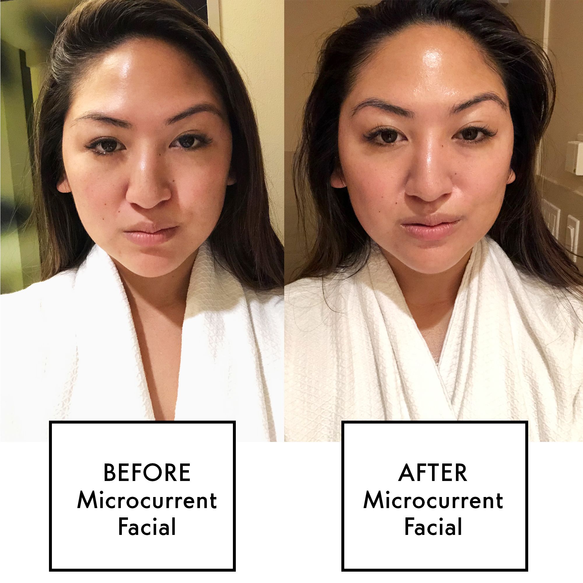 Image result for face ems before after