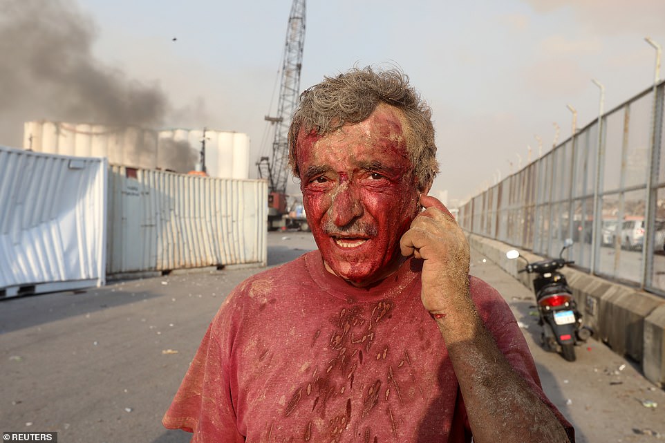 An injured man is seen in Beirut following the explosion